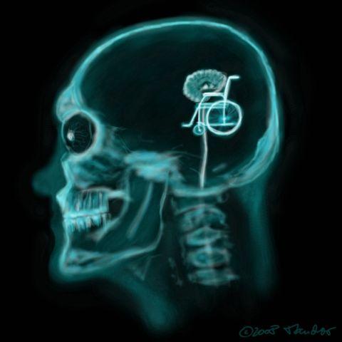 cartoon xray