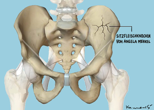 Cartoon: Merkels Sitzfleischknochen (medium) by marian kamensky tagged angela,merkel,skiunfall,urlaub,angela,merkel,skiunfall,urlaub