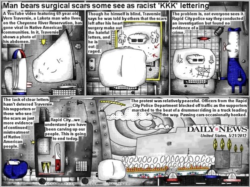 Cartoon: kkk scars (medium) by bob schroeder tagged toutube,video,viral,community,abdomen,scar,heart,surgery,letters,police,investigation,crime,mistreatment,protest