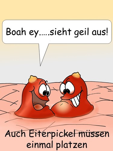 Cartoon: Eiterpickel (medium) by wista tagged eiter,pickel,akne,eiterpickel,krankheit,haut,hautkrankheit,unreine,unrein,poren,fett,fettige,pubertät