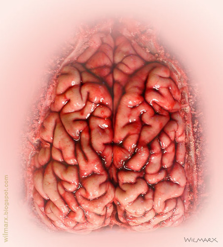 Cartoon: Love is in the head (medium) by Wilmarx tagged love,brain,head