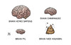 Cartoon: Nice Assasin (small) by Harm Bengen tagged nice,assasin,terror,brain