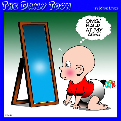 Baldness Baldness