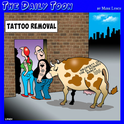 Tattoo removal Tattoo removal