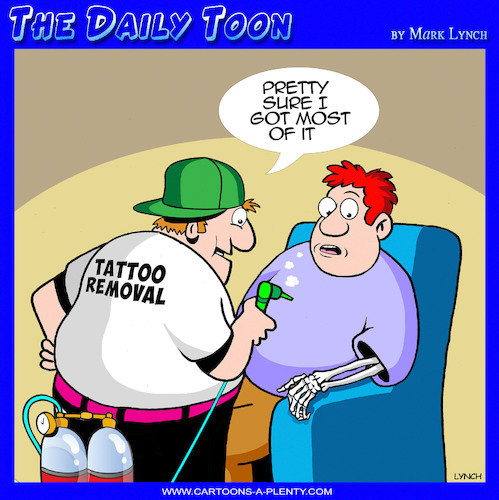Tattoo removal Tattoo removal