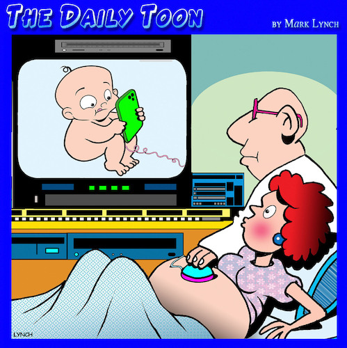 Ultrasound Ultrasound
