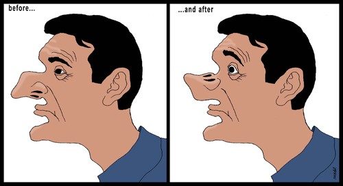 Cartoon: noses plastic surgery (medium) by Medi Belortaja tagged humor,face,men,man,surgery,plastic,nose