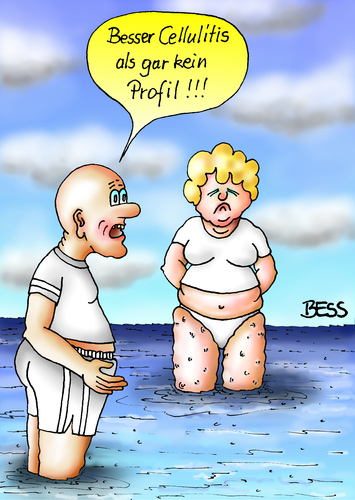 Cartoon: Cellulitis (medium) by besscartoon tagged mann,frau,paar,ehe,beziehung,cellulitis,gesundheit,meer,schönheit,profil,beine,baden,bess,besscartoon