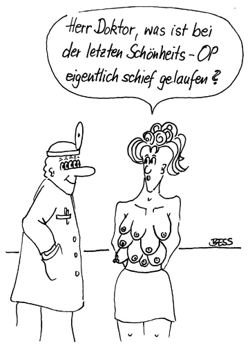 Cartoon: Wer schön sein will muss leiden (medium) by besscartoon tagged arzt,chiruge,schönheit,schönheitsoperation,schönheitschirurgie,kunstfehler,bess,besscartoon